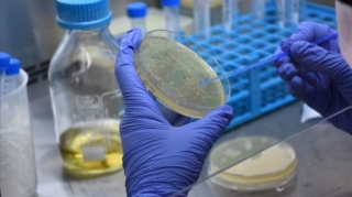 Koronavirusla bağlı SON STATİSTİKA 