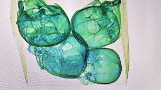 Meksikada aeroportda bağlamadan insan kəllələri çıxdı - FOTO 