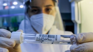 Azərbaycanda daha 62 nəfər COVID-19-a yoluxub