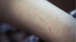 Salyanda kişi qısqanc sevgilisini döyüb dişlədi 