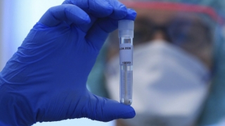 Azərbaycanda son sutkada 1157 nəfər COVID-19-a yoluxub, 31 nəfər ölüb