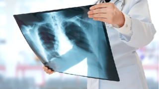 Rentgen müayinəsinə gedərkən DİQQƏTLİ OLUN!  - Nazirlik əhaliyə MÜRACİƏT ETDİ   - VİDEO