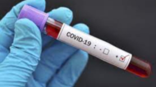 Azərbaycanda daha 31 nəfər COVID-19-a yoluxdu