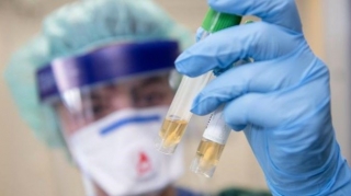 Heç vaxt Afrikada olmayan şəxs Omikron ştammına yoluxdu  