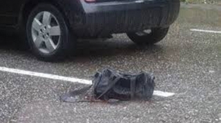 Bakı sakini sevgilisini qəsdən avtomobillə vurub