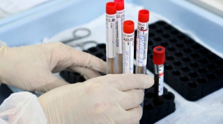 Koronavirusla bağlı SON STATİSTİKA 