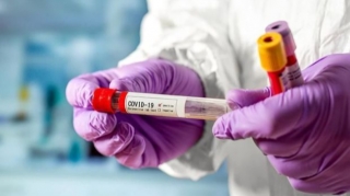 Azərbaycanda koronavirusa yoluxanların sayı açıqlandı 