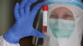 Azərbaycanda koronavirusa yoluxanların sayı açıqlanıb