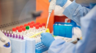 Azərbaycanda daha üç nəfər koronavirusdan öldü: 141 yeni yoluxma - FOTO 