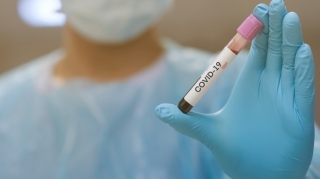 Son sutkada Azərbaycanda 325 nəfər koronavirusa yoluxub, 7 nəfər ölüb 