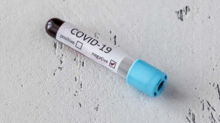 Azərbaycanda daha 86 nəfər koronavirusa yoluxub, 26 nəfər sağalıb  - FOTO