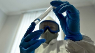 Baş infeksionist: “Ölkədə koronavirusa yoluxma faktı artıb, bu gözlənilirdi”