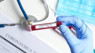 Koronavirusla bağlı SON STATİSTİKA 