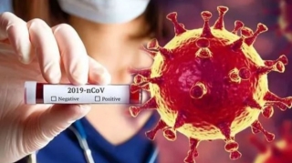  Azərbaycanda yaş, cins bölgüsü üzrə virusa yoluxma, sağalma və ölüm SAYI 