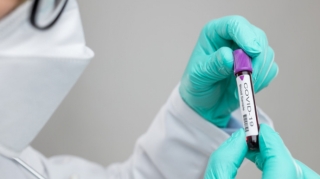 Pakistanda koronavirusdan ölənlərin sayı 4762 nəfərə çatıb