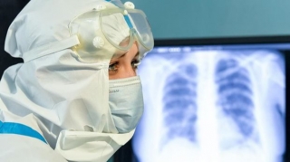 COVID-19 xəstələrinə təsir edən infeksiya