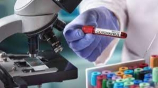 Azərbaycanda daha 668 nəfər koronavirusa yoluxub, 3 nəfər vəfat edib