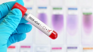 93 yeni yoluxma faktı qeydə alınıb, 2 nəfər ölüb  - FOTO