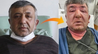 Şübhə taksi sürücüsünü xəstəxanalıq etdi  - VİDEO - FOTO