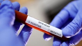 Yaponiyada koronavirusa rekord yoluxma...