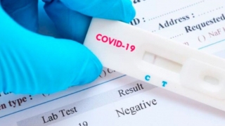 Azərbaycanda son sutkada 143 nəfər COVID-19-a yoluxub,  2 nəfər vəfat edib 