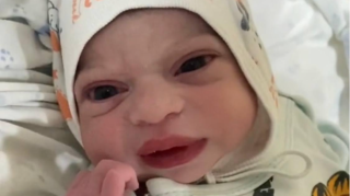 Azərbaycanda doğulan körpənin görünüşü müzakirələrə səbəb oldu - VİDEO 