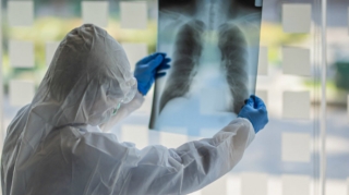 Bakıda bu xəstəxanalarda rentgen qadağan olundu  - FOTO