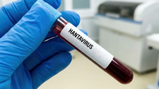 Hantavirus insandan insana nadir halda keçir - Rəsmi 