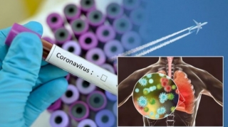 Quba RİH-i başçısının müavini və şöbə müdiri koronovirusa yoluxub