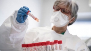 Azərbaycanda son sutkada koronavirusa yoluxanların sayı açıqlanıb 