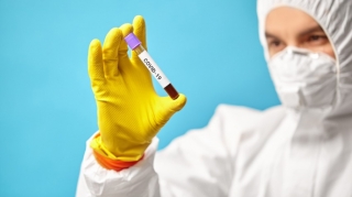 Son sutkada Azərbaycanda 49 nəfər koronavirusa yoluxub