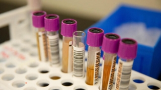 Peyvənddən neçə gün sonra antikor səviyyəsi düşür?