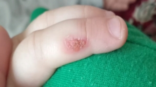 “3 yaşlı uşağım bağçada ağlayanda bıçağı qızdıraraq əlinə basıb” - VİDEO - YENİLƏNİB