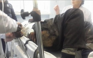 Üzərinə benzin töküb özünü yandırdı