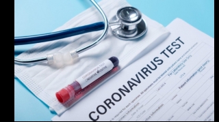Azərbaycanda daha 2597 nəfər koronavirusa yoluxub