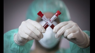 Azərbaycanda indiyədək 2163064 koronavirus testi aparılıb