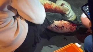 SON DƏQİQƏ!  Ermənistan, nümayişçiləri qumbara yağışına tutub  - FOTO