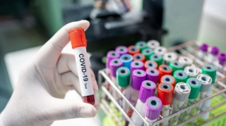 Azərbaycanda indiyədək 1404543 koronavirus testi aparılıb