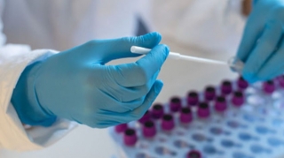 COVID-19-un yeni ştammı daha bir pandemiya dalğasına səbəb ola bilər - ÜST-dən XƏBƏRDARLIQ 