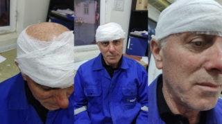 "Azəriqaz" əməkdaşına xəsarət yetirən şəxs həbs edilib 