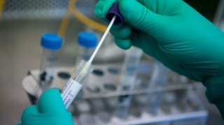 Bu günə olan koronovirus STATİSTİKASI 