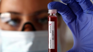 Koronavirusa bu günə olan yoluxma sayı bəlli oldu