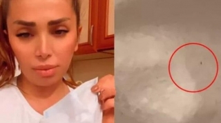 İstifadə etdiyimiz maskalarda qurd var?   - DƏHŞƏTLİ VİDEO