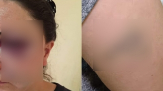 “Ata-anam deyirdi hamı döyülə-döyülə arvad olur” - 14 il şiddət görən qadın danışdı - VİDEO 