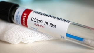 Koronovirusla bağlı bu günün STATİSTİKASI 