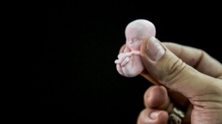 Qanunsuz aborta görə cəzalar SƏRTLƏŞDİRİLİR 