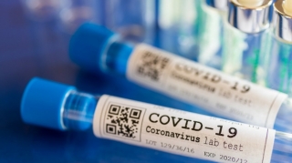 Azərbaycanda daha 577 nəfər koronavirusa yoluxub, 9 nəfər ölüb 