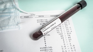 Azərbaycanda daha 75 nəfər COVID-19-a yoluxub, 3 nəfər vəfat edib  - FOTO