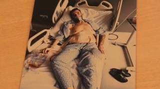 Təkrar mədəkiçiltmə əməliyyatı ciddi fəsadlar yaratdı - VİDEO