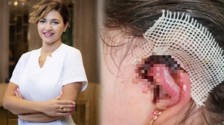 “Həkimin əməliyyatından sonra qızımın qulağında çürümə oldu” 